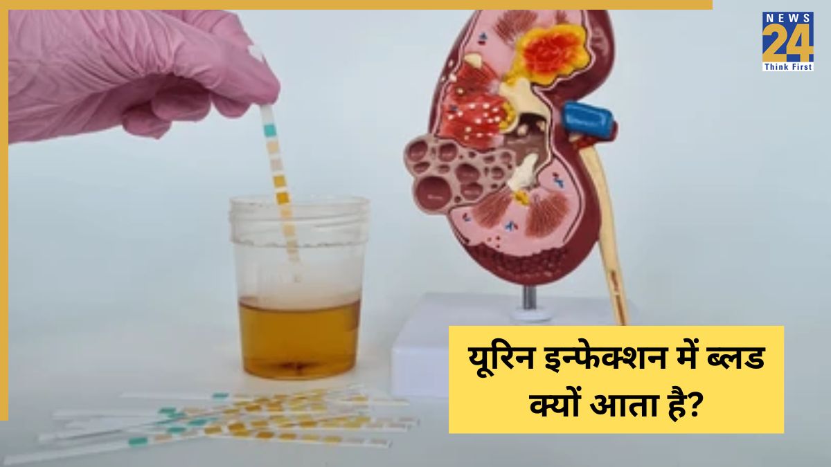 Peshab Mein Khoon Aana-1