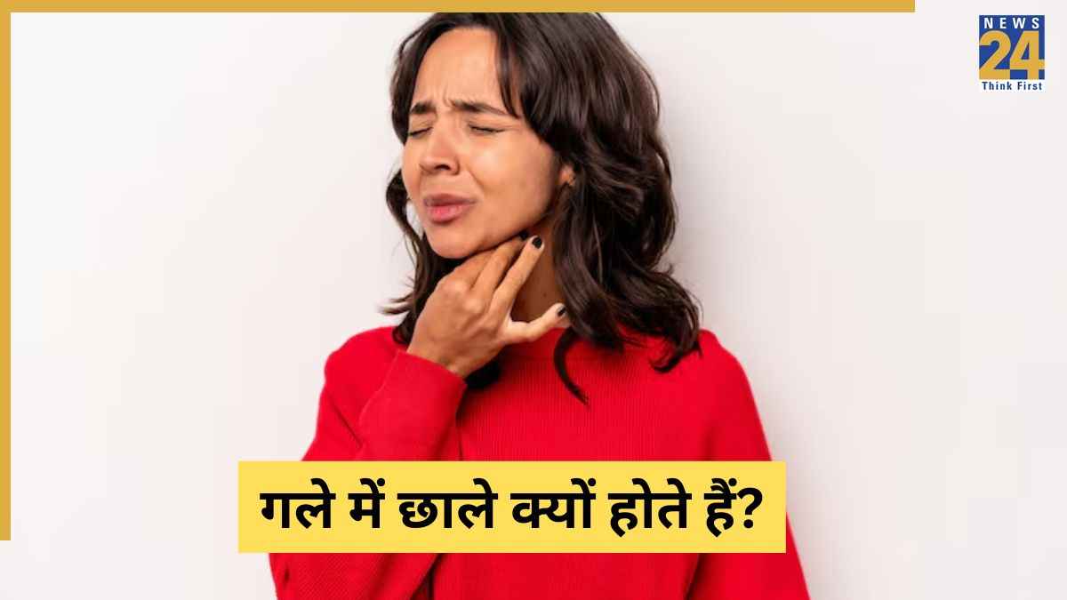 Throat Sores