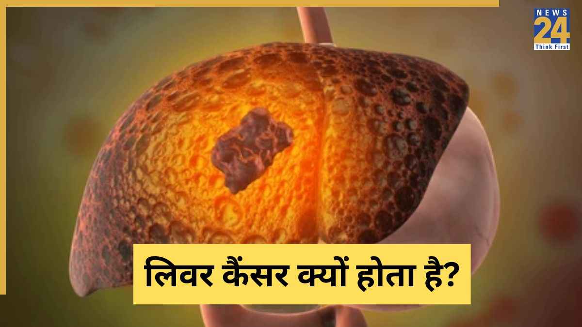 liver cancer disease last stage