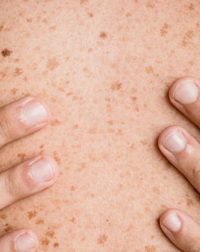 Diabetes gambhir hone ke lakshan-1-2