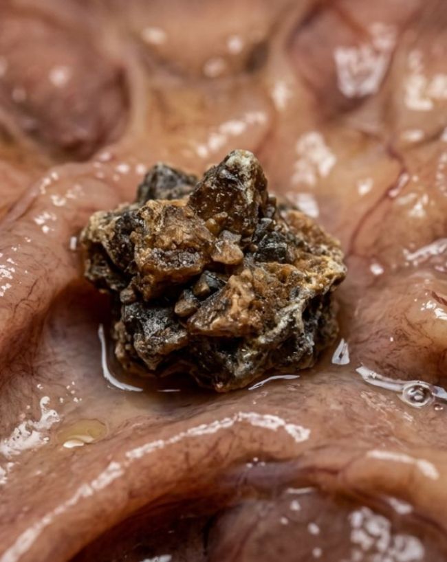 Dal For Pathri-1-2-3-4-5