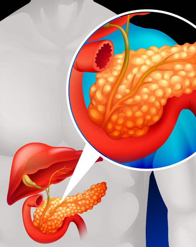 Pancreatic Cancer Symptoms-1-2-3-4