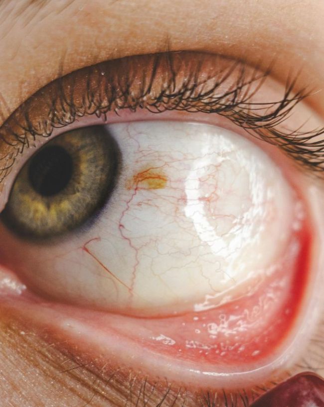 AC Side Effects In Hindi-1-2