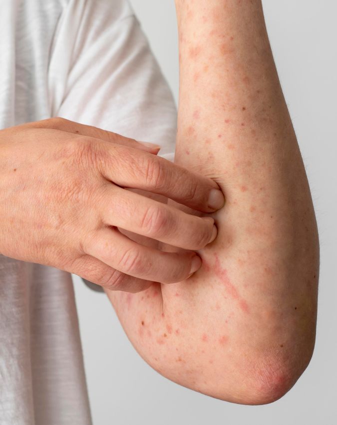 Kis Vitamin ki kami se khujli hoti hai-1-2-3