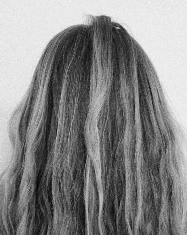 Vitamin Deficiency White Hair-1-2-3-4-5