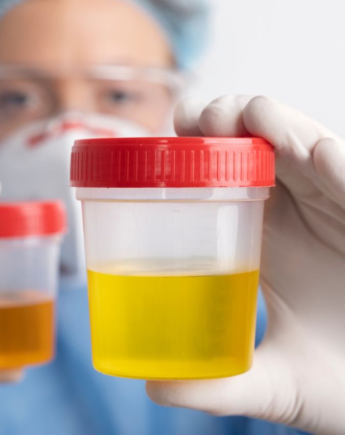 UTI Symptoms in women-1-2-3