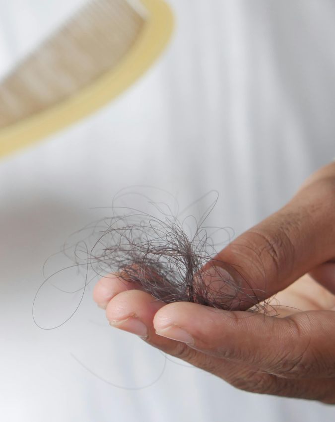 Which vitamin deficiency causes hair fall-1-2-3-4-5