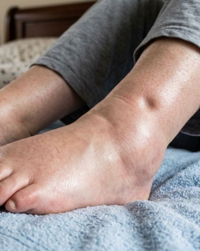 Peshab me jhag aane ke karan-1-2-3-4-5-6-7