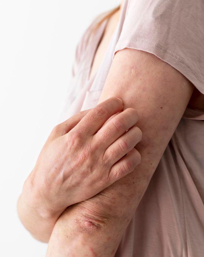 Kis Vitamin ki kami se khujli hoti hai-1-2-3-4-5