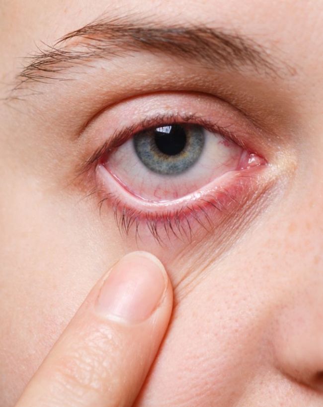 Why I like to eat ice-1-2