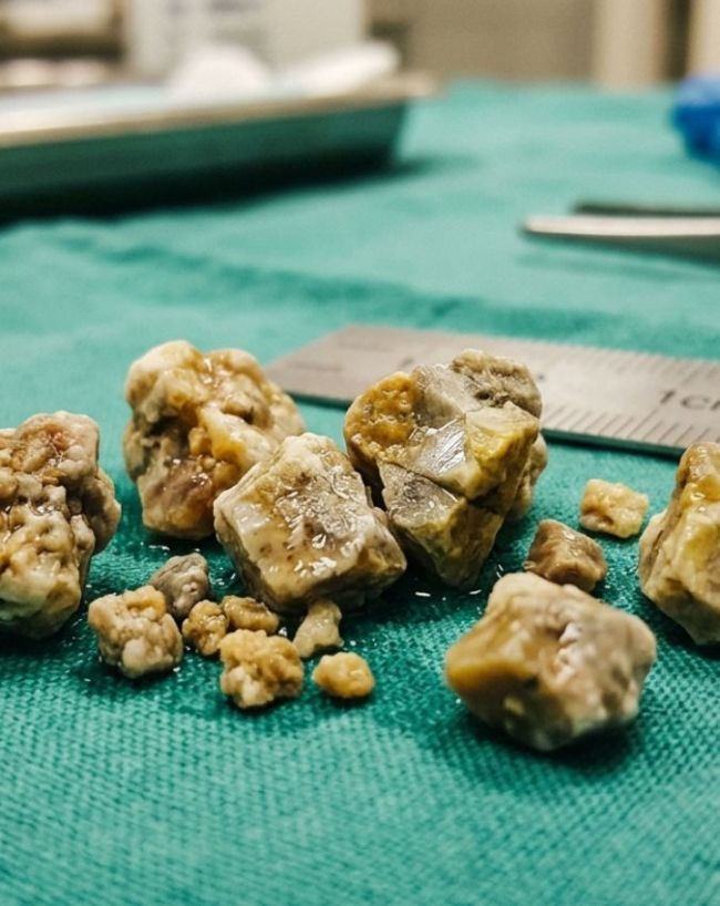 Dal For Pathri-1-2-3-4