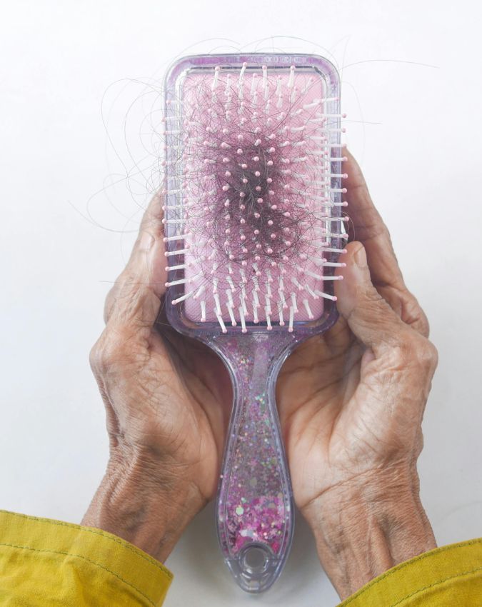 Which vitamin deficiency causes hair fall-1-2-3-4-5-6