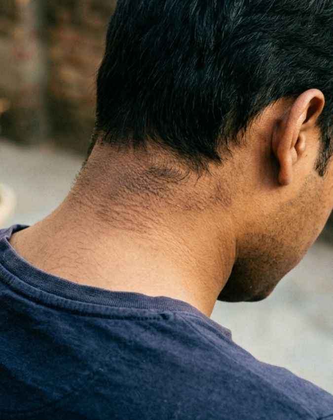 कुछ हिस्सों का काला दिखना 