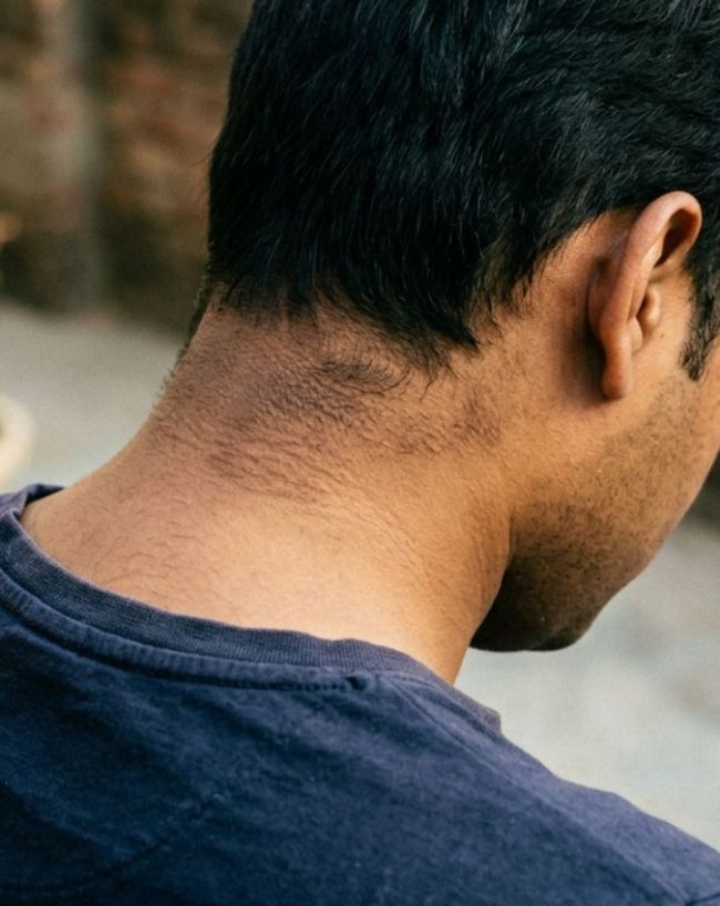 Diabetes gambhir hone ke lakshan-1-2-3-4-5-6