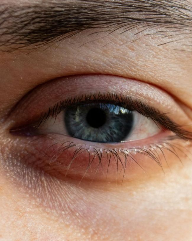 Low BP ke lakshan-1-2-3-4-5