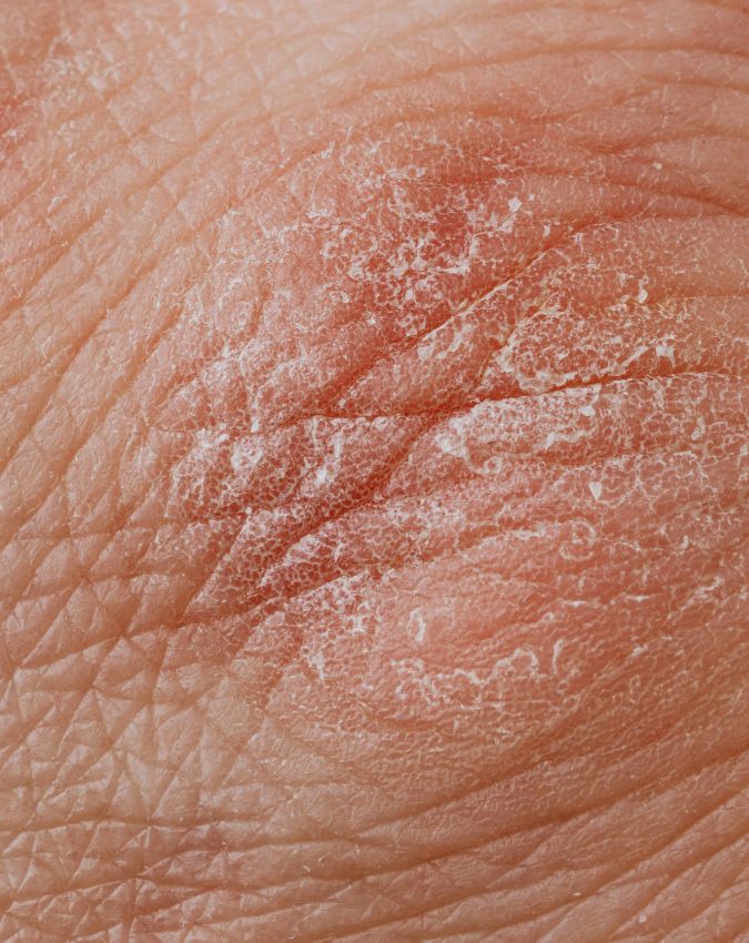 Kis Vitamin ki kami se khujli hoti hai-1-2-3-4-5-6-7