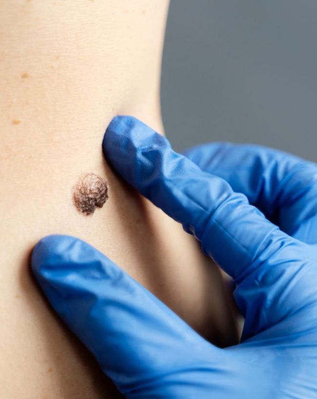 Diabetes gambhir hone ke lakshan-1-2-3-4-5-6-7