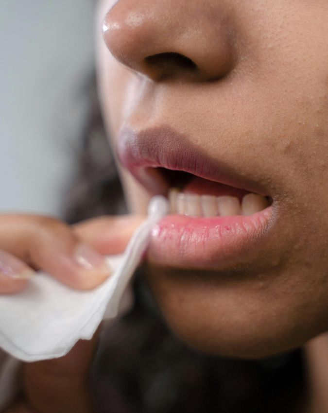 Kis Vitamin Ki Kami Se Muh Se Laar Girti Hai-1-2-3