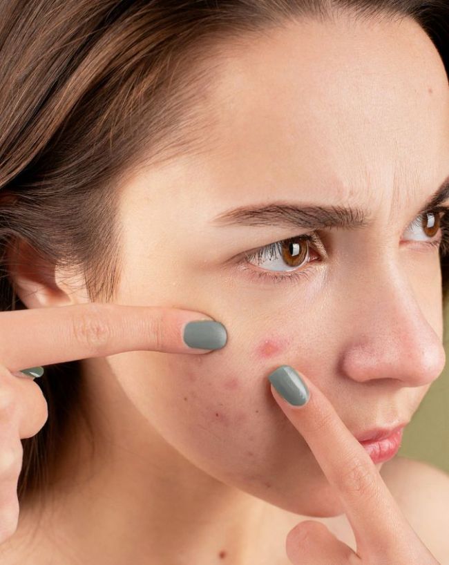 Curry Leaves Benefits-1-2-3-4-5-6