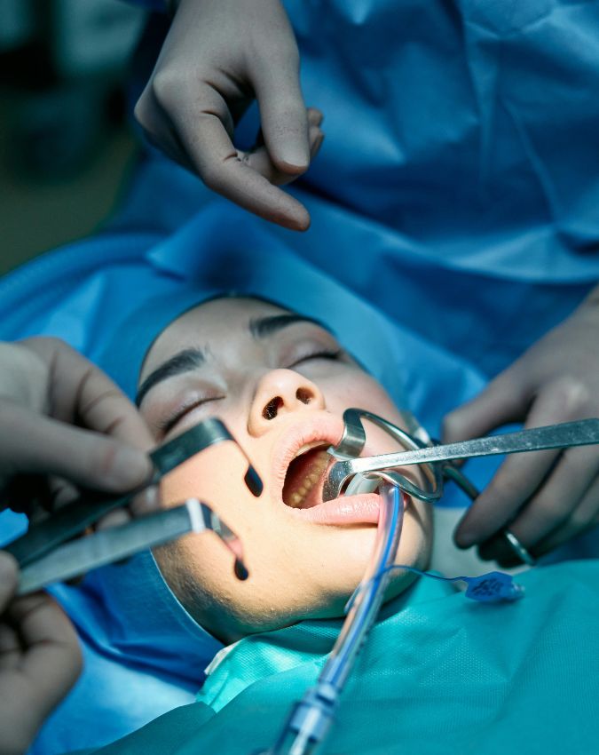 Tongue cancer treatment-1-2-3