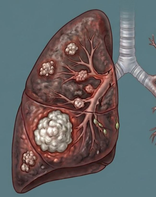 Gutka Khane Se Kya Hota Hai-1-2-3-4