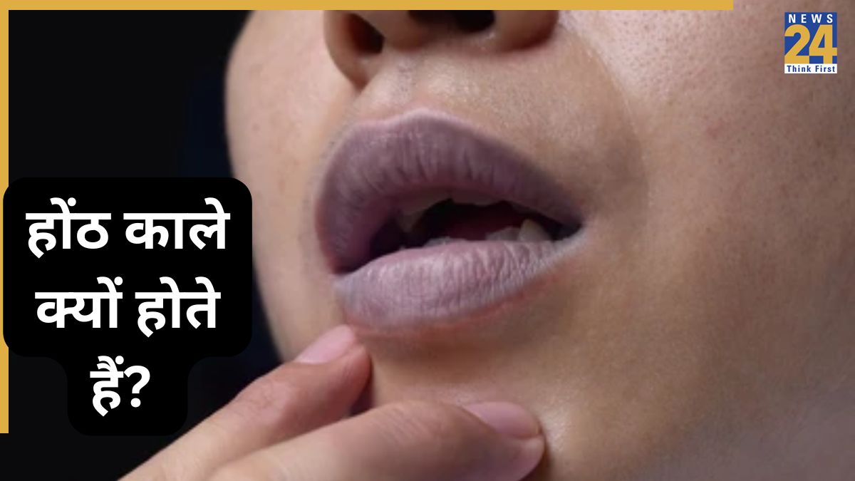 Vitamin Deficiency Lips Turning Black-1