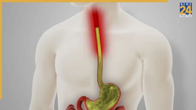 Gale Mein Jalan Kyu Hoti Hai Gale Mein Jalan Kyu Hoti Hai-1