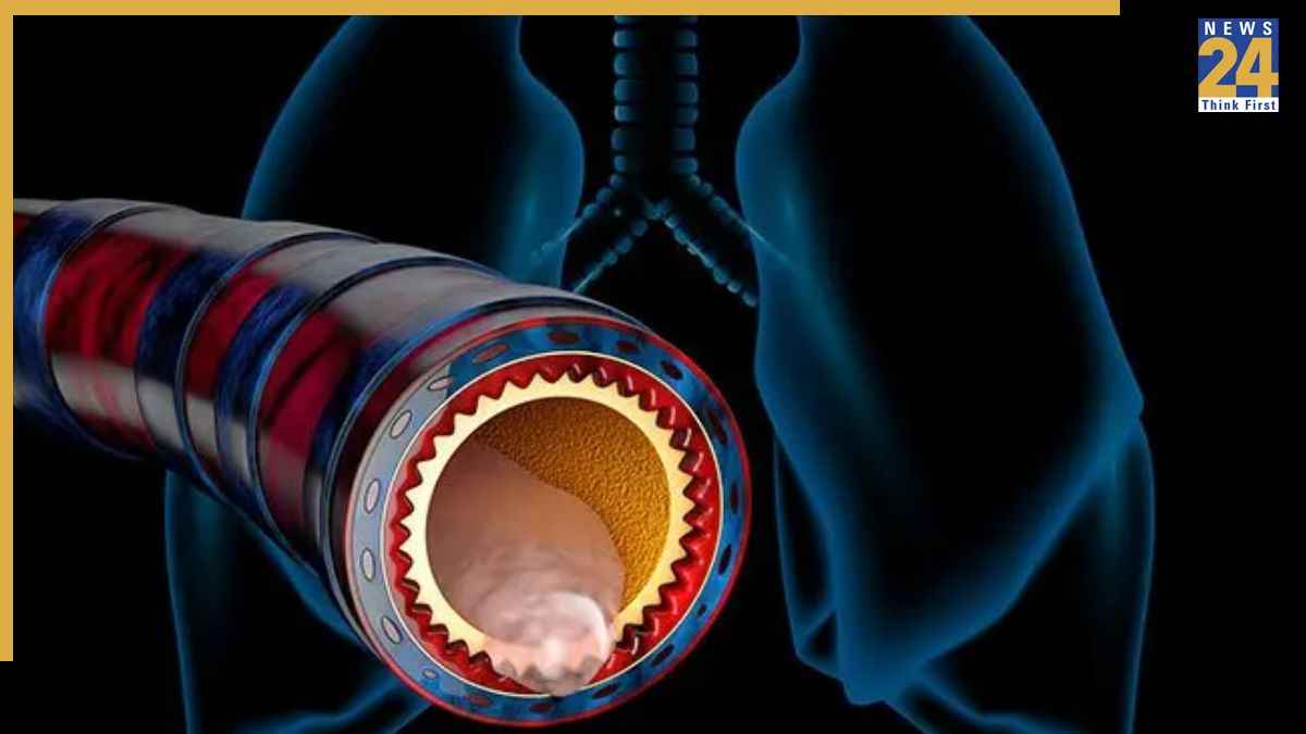 अप्रैल की ठंड से छाती में जकड़ गया बलगम? महंगी दवा करने के बजाय अपनाएं ये देसी नुस्खे