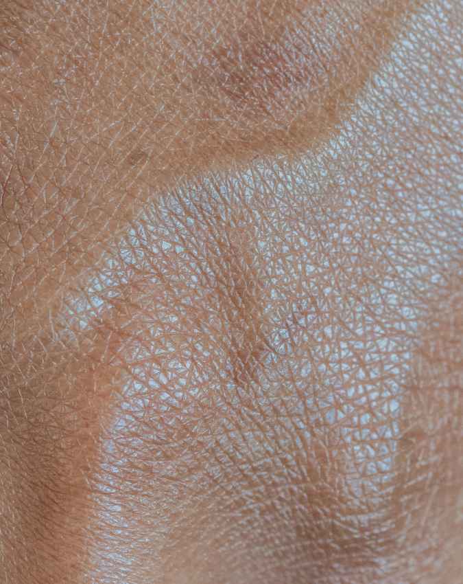 क्या नसों में गांठ होना सामान्य है?