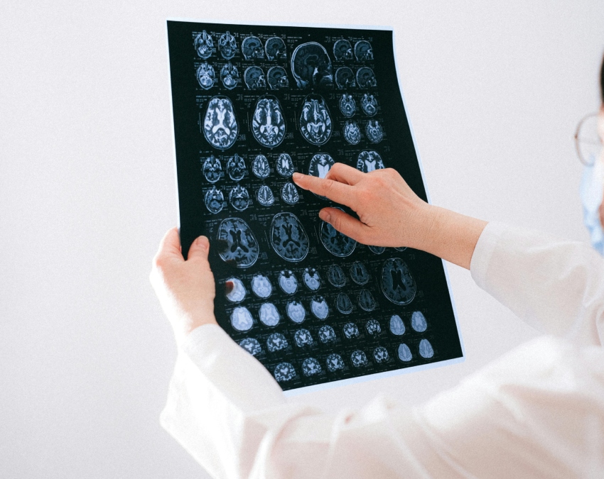 Brain Hemorrhage-1-2-3-4-5-6-7