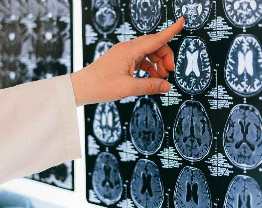 संतुलित जीवनशैली से करें दिमाग की सुरक्षा