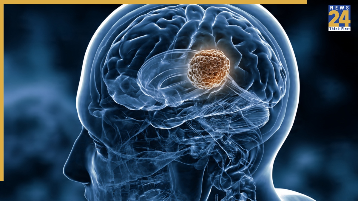 Brain Tumor Symptoms -1