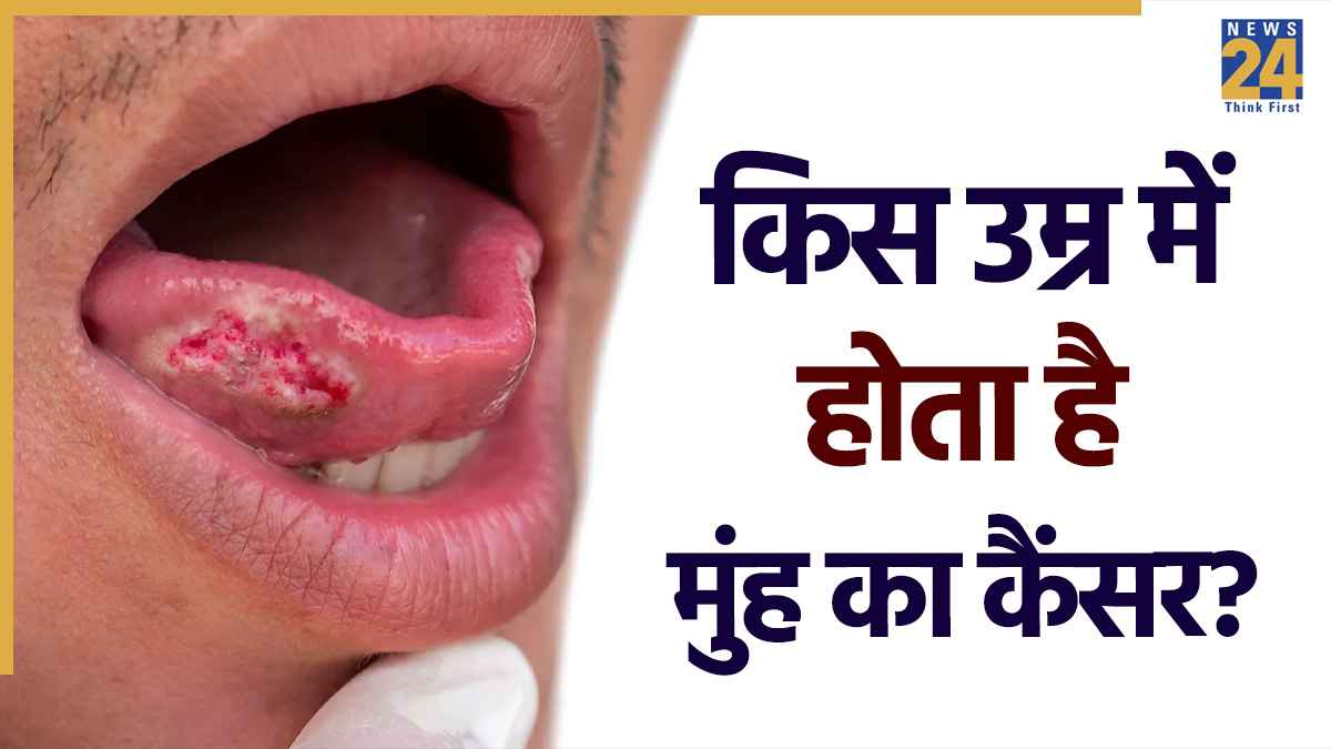 Oral Cancer
