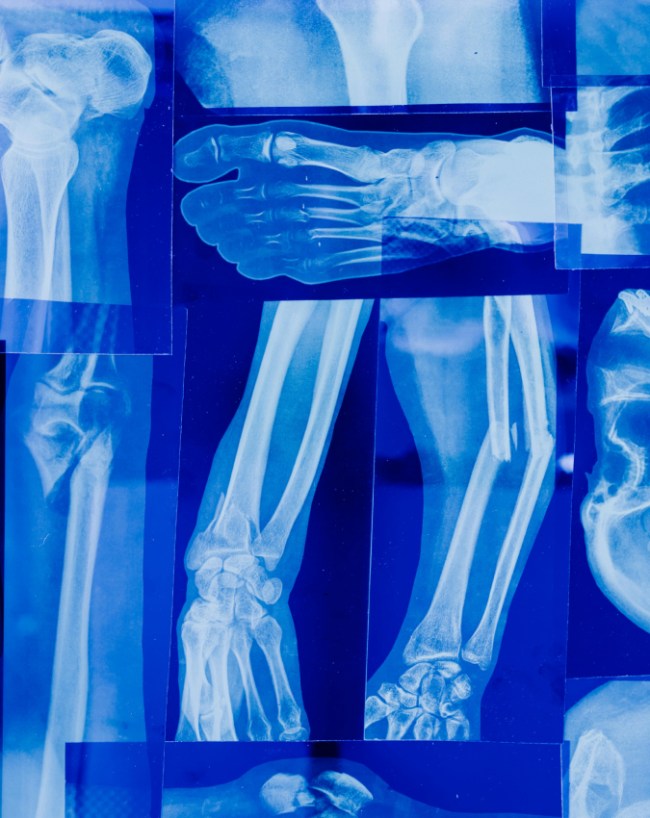 Pathar Jaisi Mazboot Haddiyan-1-2