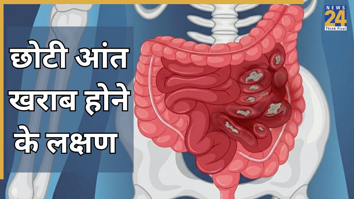 Chhoti Aant Kharab Hone Ke Lakshan-1