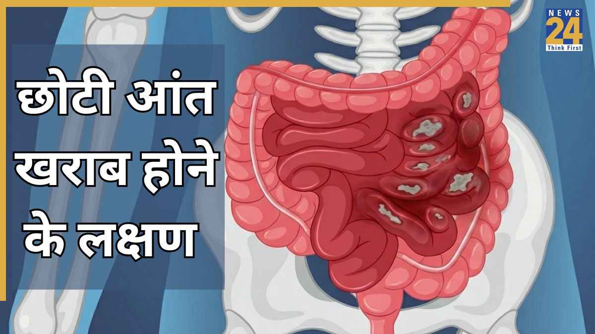 Chhoti Aant Kharab Hone Ke Lakshan Chhoti Aant Kharab Hone Ke Lakshan