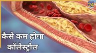 Cholesterol reducing foods