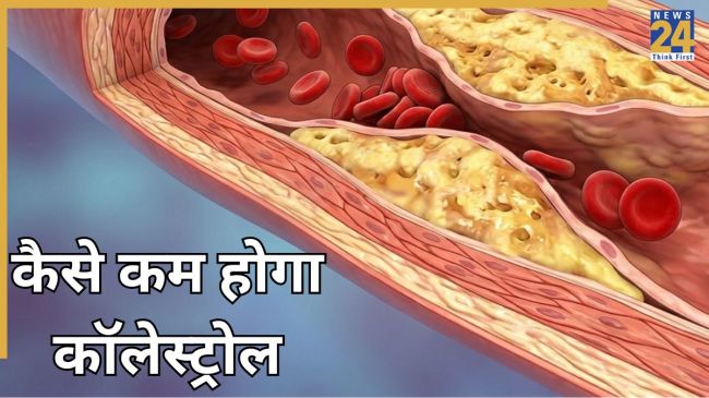 Cholesterol reducing foods
