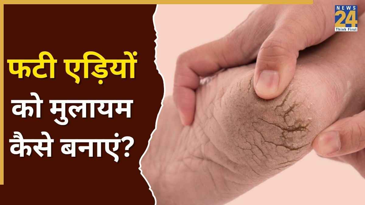Cracked Heels Home Remedies