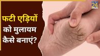 Cracked Heels Home Remedies