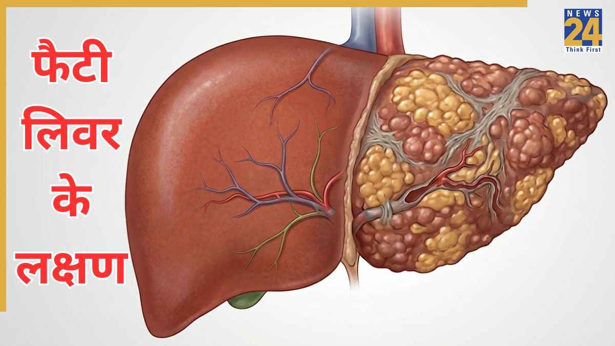 Fatty liver symptoms in hindi