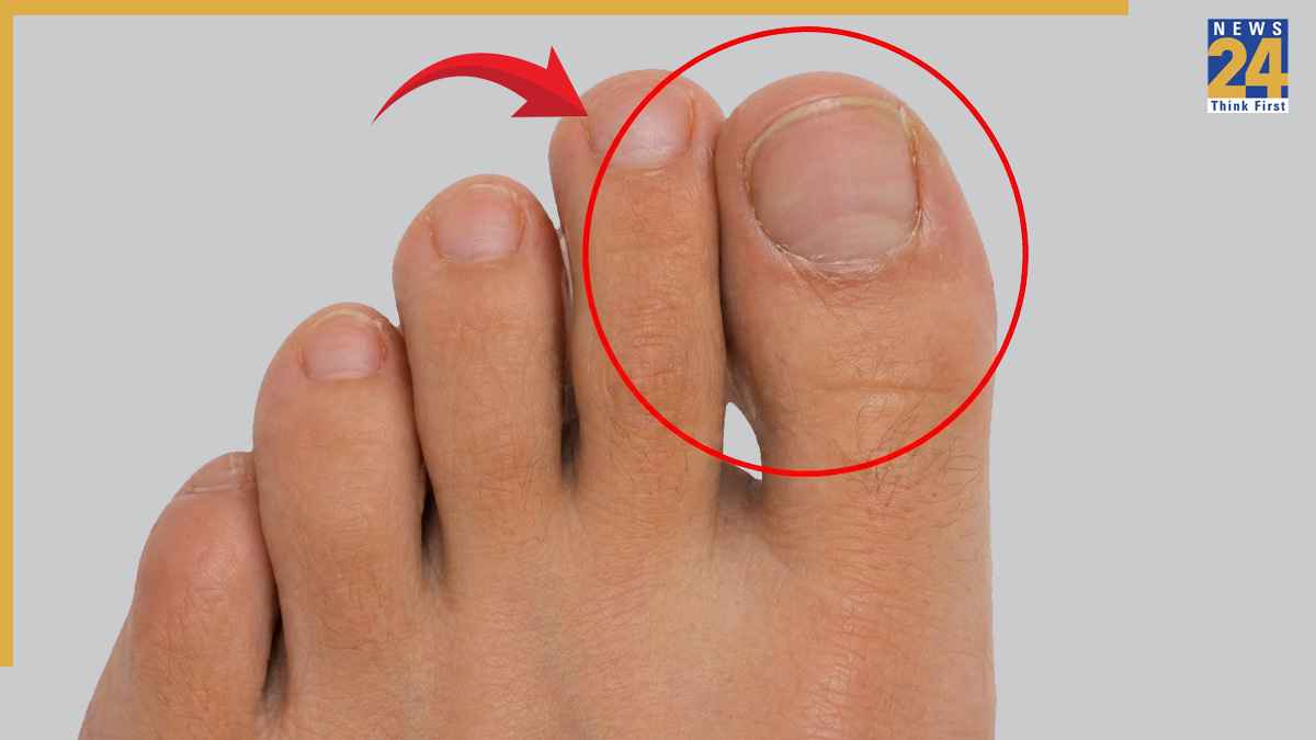Finger Bigger Than Thumb Meaning