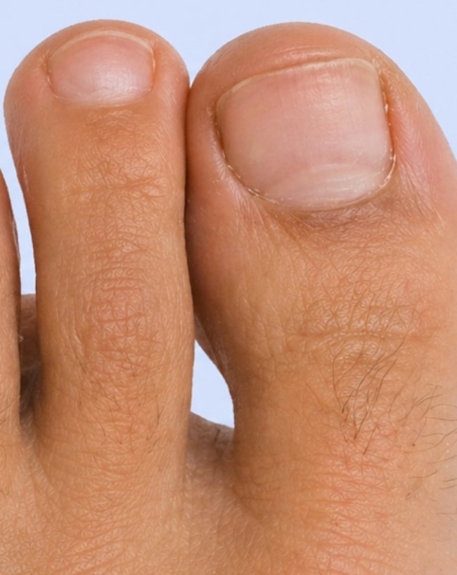 Finger Bigger Than Thumb Meaning-1-2