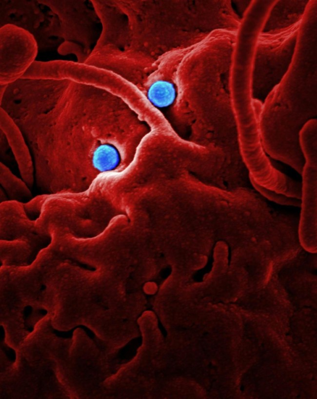 HIV AIDS Risk Male Vs Female-1-2-3-4-5-6