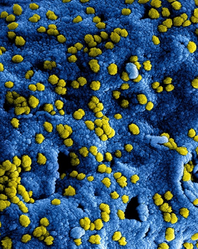 HIV AIDS Risk Male Vs Female-1-2-3-4