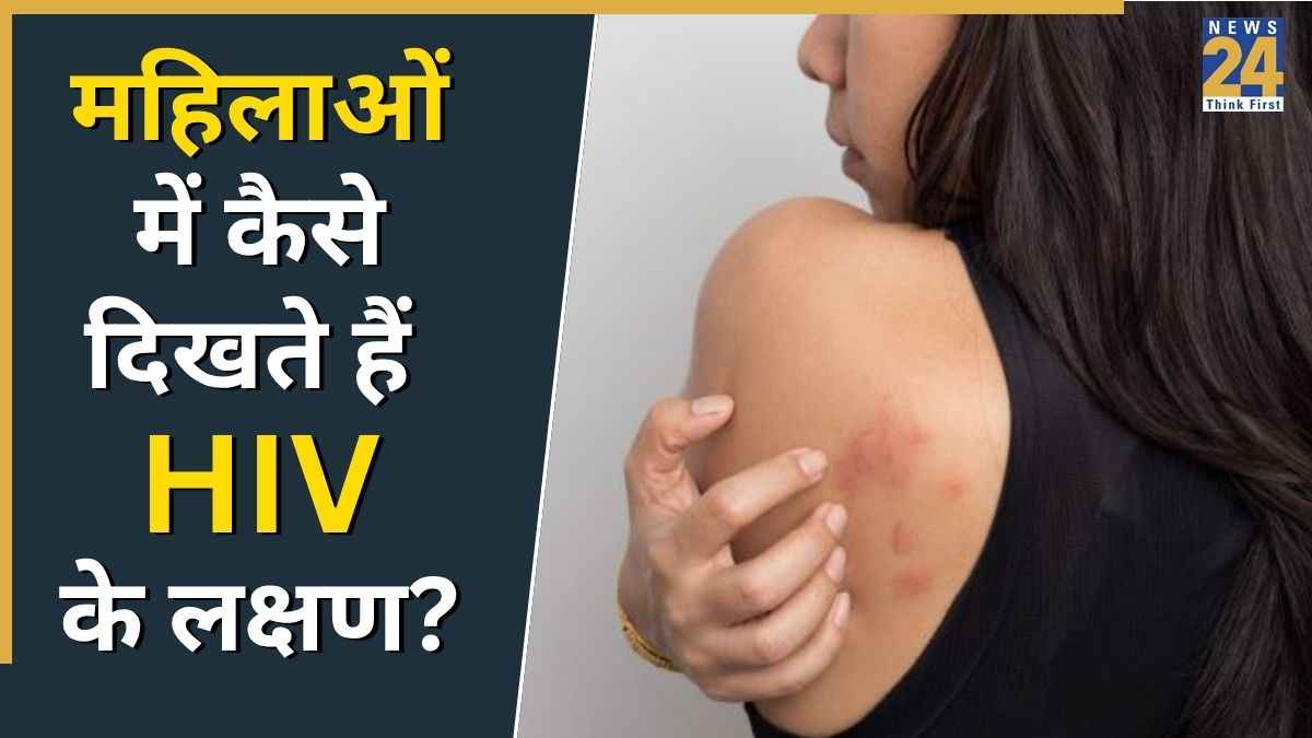 HIV AIDS Symptoms In Women