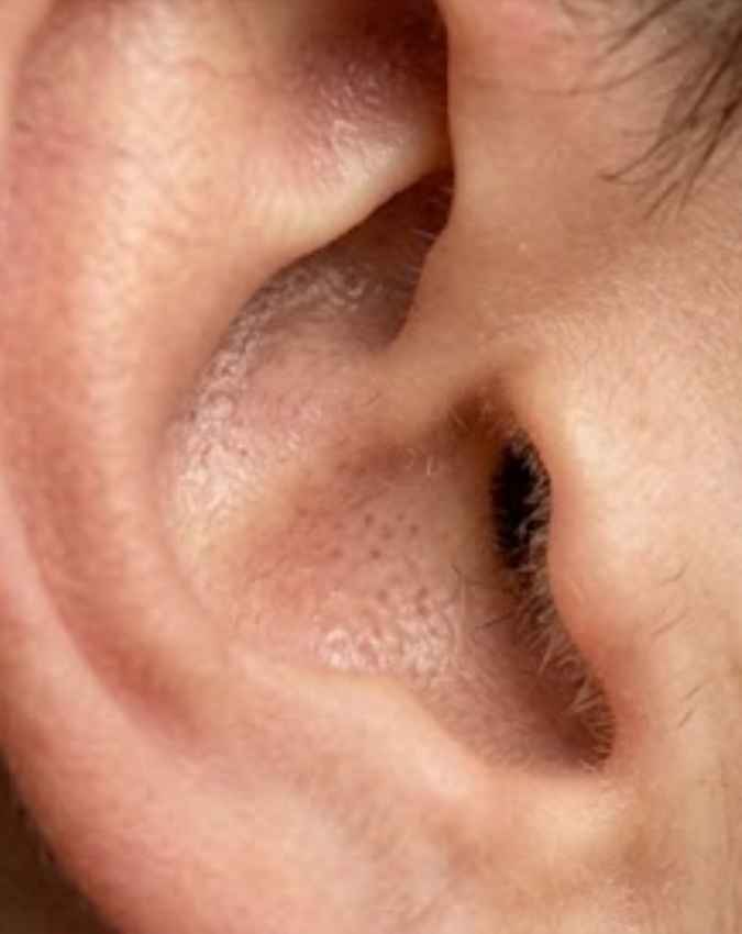 घने बाल क्या दर्शाते हैं?