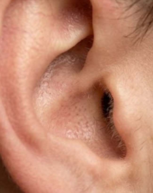 Hair On Ears-1-2-3-4