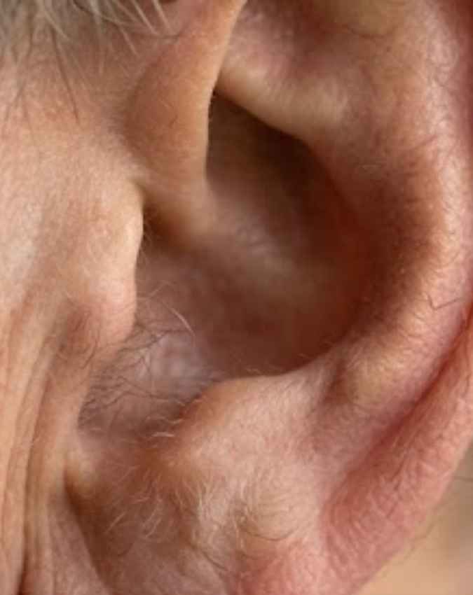 कान पर हल्के बाल आना कैसा होता है?