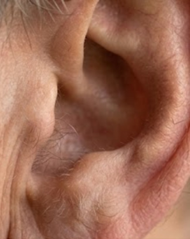 Hair On Ears-1-2-3-4-5